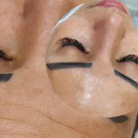 فیشیال تخصصی صورت با تخفیف برای فرصت محدود