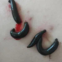 طب سنتی