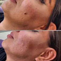 تخفیفات۵۰ درصدی ژل،بوتاکس،انزیم کیلینیک هستی|خدمات آرایشگری و زیبایی|کرمانشاه, |دیوار