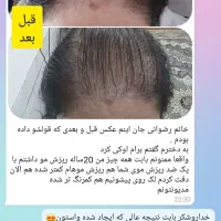تونیک تقویت و رشد مو|آرایشی، بهداشتی، درمانی|تهران, ایرانشهر|دیوار