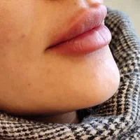 تخفیف واقعی بلک فرایدی فیلر و ژل و آنزیم و.. مطهری