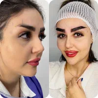 جشنواره تخصصی میکرو‌کاشت ابرو‌در شیراز|خدمات آرایشگری و زیبایی|برازجان, |دیوار