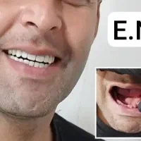 دندان سازی اردبیل