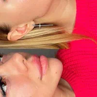 تزریق ژل بوتاکس فیلر بادی توسط پزشک در کلینیک لوکس|خدمات آرایشگری و زیبایی|مشهد, هفت تیر (حافظ)|دیوار