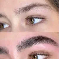 لیفت ابرو و مژه صورت