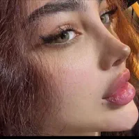 فیلربادی۱۵۰مزو،بوتاکس،انزیم.فول فیس،فیلر۵۵۰|خدمات زیبایی و سلامت|کرج, گوهردشت|دیوار