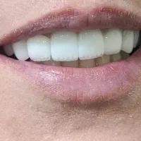 دندانپزشکی بیمه تامین اجتماعی کمیته امدادوبهزیستی|خدمات آرایشگری و زیبایی|نورآباد, |دیوار