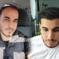 کاشت مو و ابروی طبیعی مزو و پی آرپی جلوگیری ریش مو|خدمات آرایشگری و زیبایی|تبریز, |دیوار