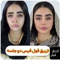 برداشتن خال۱۰ هزار تومن دریک جلسه،فیلر۳۹۰،جوانسازی|خدمات آرایشگری و زیبایی|کرج, گوهردشت|دیوار
