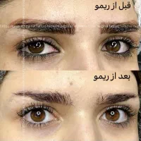 پاک کردن تاتو چشم ابرو ولب