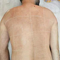 لیزر مو زائد الیت پلاس سایناشور|خدمات آرایشگری و زیبایی|تهران, مهران (سیدخندان)|دیوار