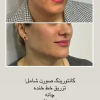 مادلینگ صورت و زاویه فک به سبک سلبریتی ها