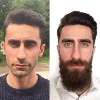 فرمول تخصصی رویش ریش