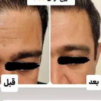 نمایندگی اصلی کرم ضد چین و چروک گاتیو(کرم ۵کاره)|آرایشی، بهداشتی، درمانی|تهران, جنت‌آباد جنوبی|دیوار