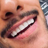 تخفیف ویژه کامپوزیت به مدت یک هفته|خدمات آرایشگری و زیبایی|اهواز, زیباشهر|دیوار
