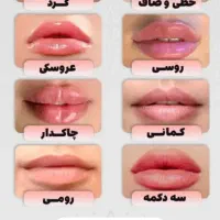بوتاکس و فیلر و ژل و خدمات زیبایی