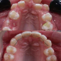 تخفیف و اقساط بلند مدت کلینیک دی|خدمات آرایشگری و زیبایی|آذرشهر, |دیوار