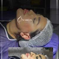 جشنواره 50% سوپرکانتورینگ غبغب|خدمات زیبایی و سلامت|تهران, آرژانتین|دیوار