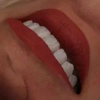 دندانپزشکی و ایمپلنت( تبریز)
