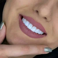 کامپوزیت و تخفیف