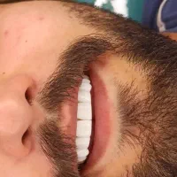 کامپوزیت