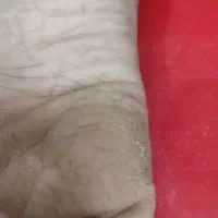 پدیکور و رفع سیاهی قوزک پا و جوانسازی دست|خدمات آرایشگری و زیبایی|برازجان, |دیوار