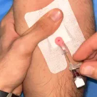 وصل سرم /تزریق عضلانی / پانسمان|خدمات آرایشگری و زیبایی|مشهد, هنرستان|دیوار