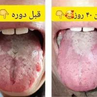 محصولات گیاهی|آرایشی، بهداشتی، درمانی|کرمانشاه, |دیوار