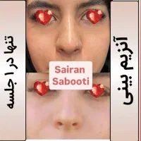 آنزیم بینی گوشتی غبغب پلاسما تراپی|خدمات آرایشگری و زیبایی|شیراز, محراب|دیوار