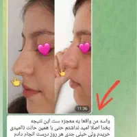 کرم کوچیک کننده بینی|آرایشی، بهداشتی، درمانی|قرقری, |دیوار