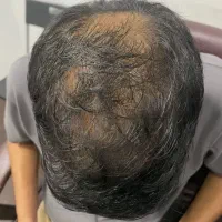 بدون مو بیا با مو برو