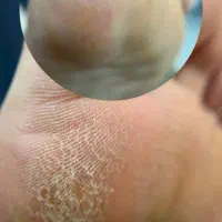 خدمات ناخن و‌پدیکور پا و ژلیش پا به صورت حرفه ای|خدمات آرایشگری و زیبایی|دزفول, |دیوار