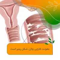 درمان طبیعی عفونت و سردی بدن بدون داروی شیمیایی|آرایشی، بهداشتی، درمانی|گنبد کاووس, |دیوار