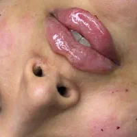 مرکز تخصصی افرینش لب روسی مادلینگ صورت بوتاکس و..|خدمات آرایشگری و زیبایی|اندیشه, |دیوار
