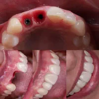دندانپزشکی تخصصی،ایمپلنت،اوردنچر،ارتودنسی|خدمات آرایشگری و زیبایی|تبریز, |دیوار
