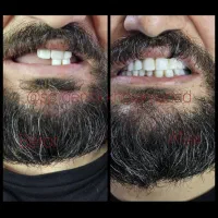 مرکز تخصصی دندانسازی اسپی دنتال|خدمات آرایشگری و زیبایی|خرمآباد, |دیوار