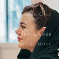 تخفیف ویژە عمل بینی(جشنوارە )|خدمات آرایشگری و زیبایی|نیشابور, خیام|دیوار