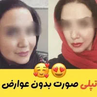 محصولات تخصصی|آرایشی، بهداشتی، درمانی|حمیدیا, |دیوار