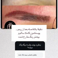 ریمو تتوی صورت(فقط بانوان)|خدمات آرایشگری و زیبایی|قم, کیوانفر|دیوار