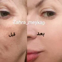 دوست داری ۱۰ سال جوان تربشوی پوست صاف میخوای