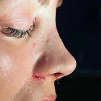 کلینیک زیبایی و جراحی بلفاروپلاستی و بینی|خدمات آرایشگری و زیبایی|فردیس, طالقانی|دیوار