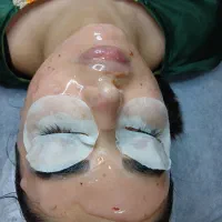 پاکسازی و فیشال تخصصی و درمانی با بهترین برندها