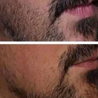 تضمینی صد در صد