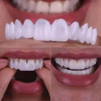 اسنپ‌آن اسمایل اصل،لمینت متحرک.کامپوزیت