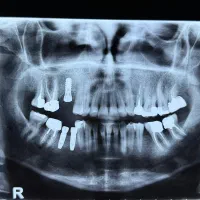 استخدام دستیار دندانپزشک
