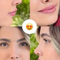 عمل بینی با پیزوسرجری/ بدون تامپون/فقط۲۵ میلیون