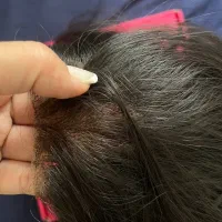 کلاه گیس زنانه درجه یک|آرایشی، بهداشتی، درمانی|تهران, تهرانسر مرکزی|دیوار