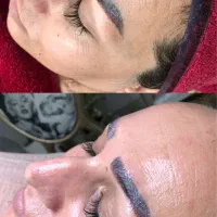 فیشال و پاکسازی پوست محمودآباد فقط یک تومان