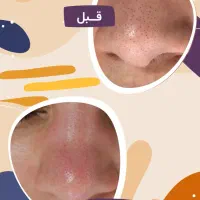 کلینیک تخصصی پوست و مو لیزر|خدمات آرایشگری و زیبایی|رباطکریم, رباطکریم|دیوار