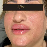 خدمات زیبایی|خدمات آرایشگری و زیبایی|خرمشهر, |دیوار